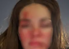 Известный красноярский стоматолог избил свою жену в центре города